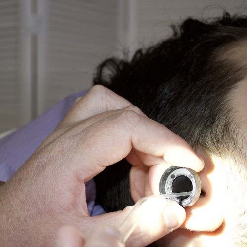 Closeup of a male patient's ear receiving microsuction