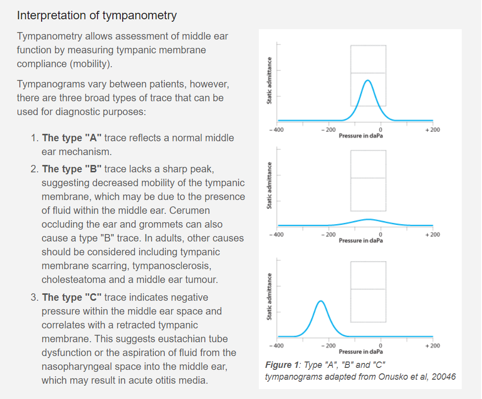 copy of a medical chart showing tympanometry results