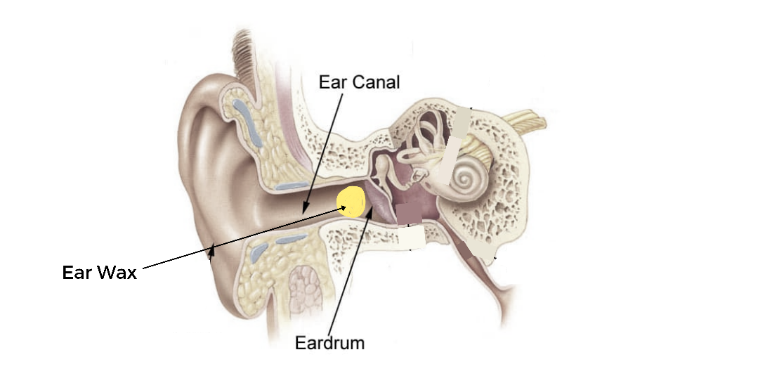 Diagram showing the ear, ear canal and ear drum