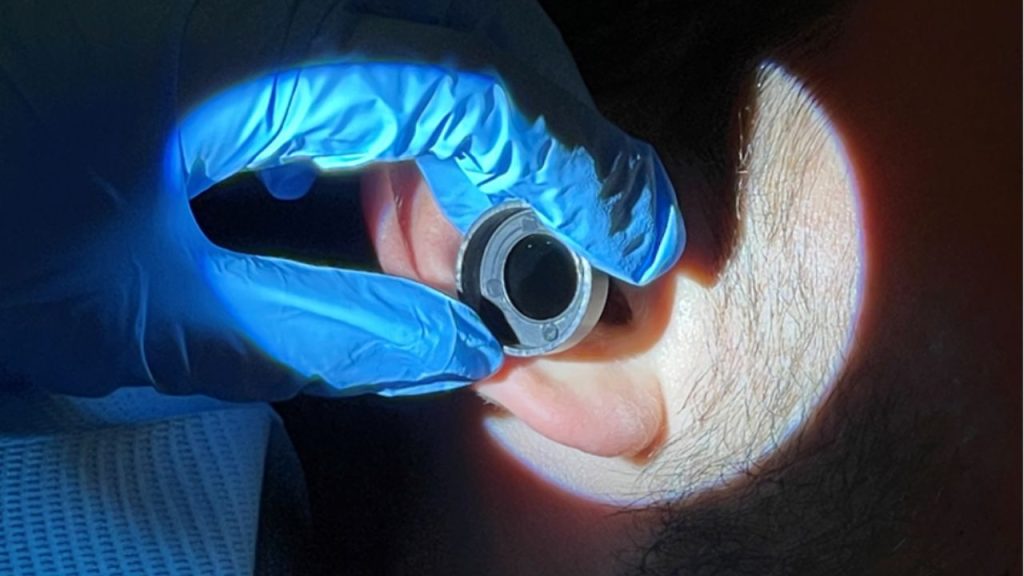 Close up of ear being microsuction cleaned by registered nurse